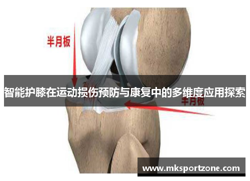 智能护膝在运动损伤预防与康复中的多维度应用探索